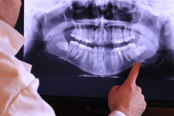 Best Emergency Treatment for Jaw Pain or Injury in Apex, NC