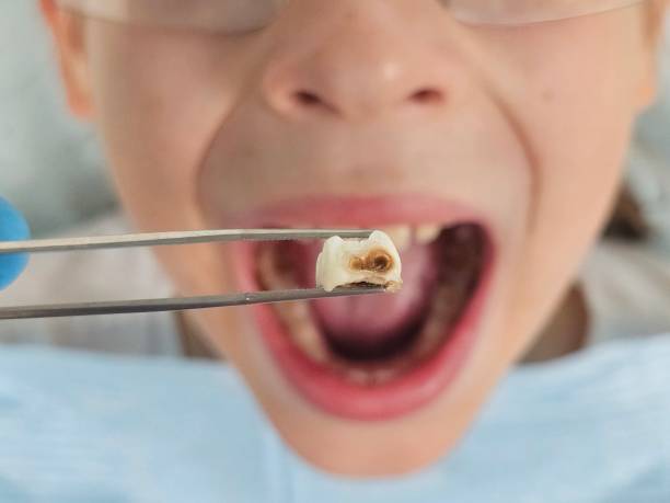 Best Walk-In Emergency Dental Services in Apex, NC